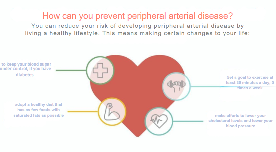 Peripheral Arterial Disease