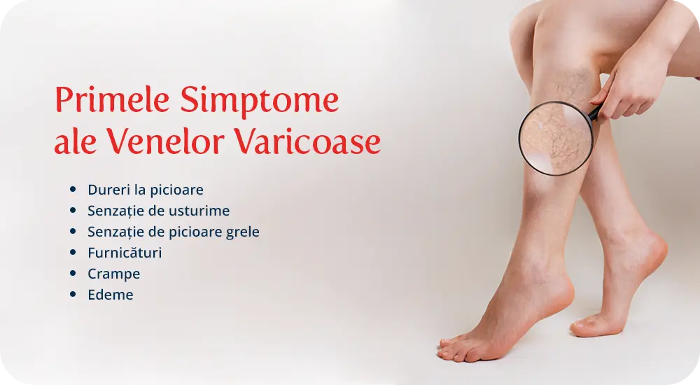 Lista cu primele simptome ale venelor varicoase