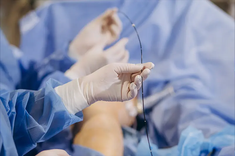 Poza de cover pentru Angioplastie