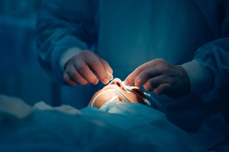 Poza reprezentativa pentru pagina de chirurgie orl.