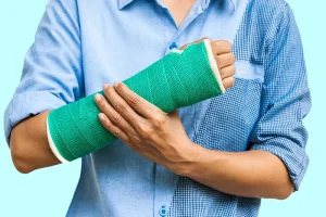 Poza reprezentativa pentru articolul Fractura la incheietura mainii