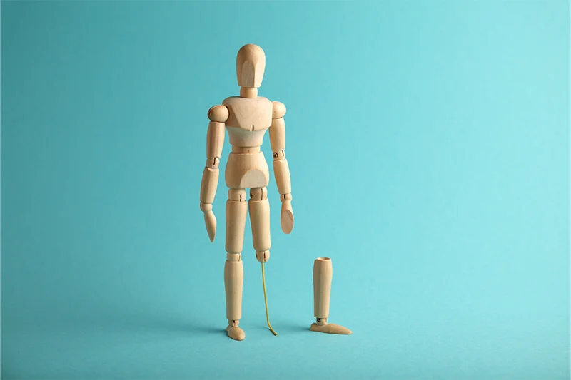 Representative photo for amputation procedure page