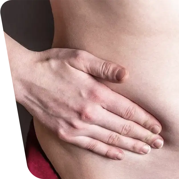 Imaginea surprinde o mână plasată peste zona abdominală, ilustrând disconfortul și durerea asociate cu herniile. Aflați mai multe despre simptome, diagnostic și opțiunile de tratament în articolul nostru specializat.