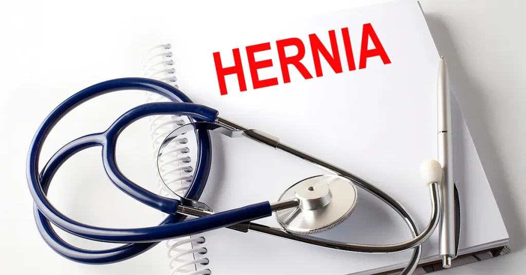 Image of a stethoscope and the text 'Hernia', illustrating the diagnosis and treatment of an inguinal hernia