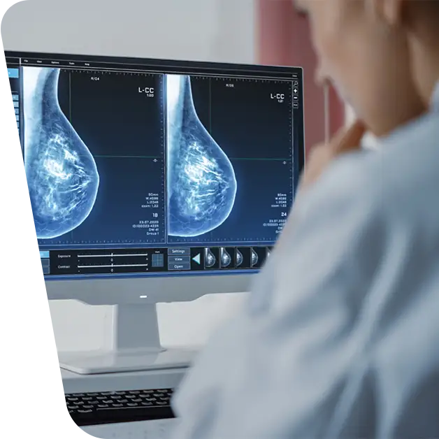 Imagine cu un medic care examinează cu atenție un ecran de monitor pentru a interpreta un screening mamar pentru detectarea cancerului de sân.