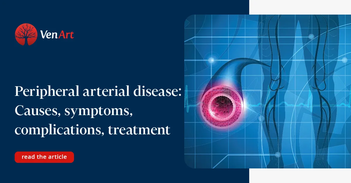 Treatment of peripheral arterial disease | VenArt Clinic