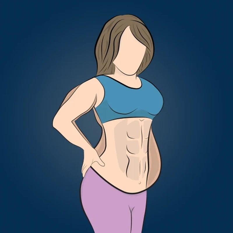 Desen inainte si dupa Abdominoplastie (Tummy tuck)
