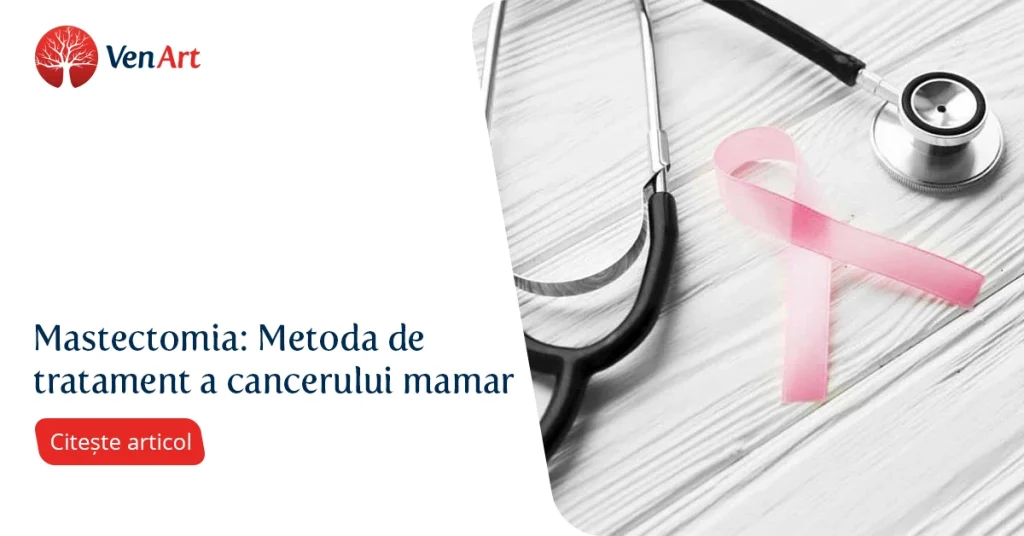 VenArt - Mastectomia - Metoda de tratament a cancerului mamar