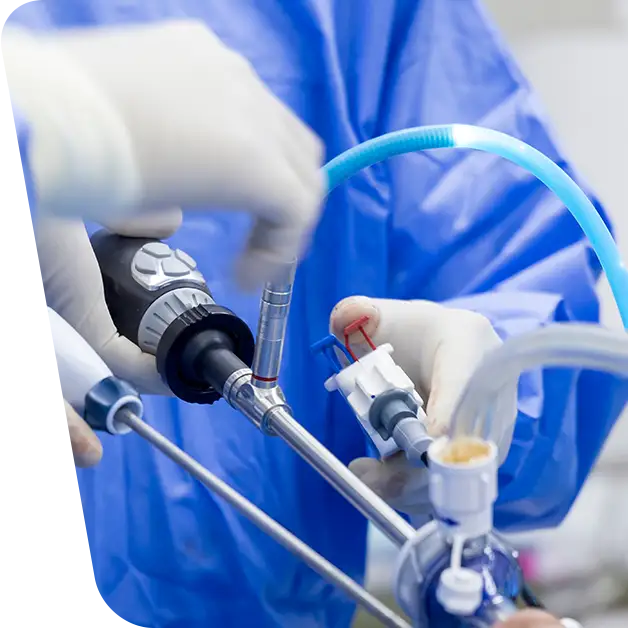 Imaginea redă o perspectivă detaliată asupra intervenției de histerectomie laparoscopică, evidențiind instrumentele medicale și tehnicile chirurgicale utilizate. Aflați mai multe despre beneficiile acestei tehnici moderne în articolul nostru specializat