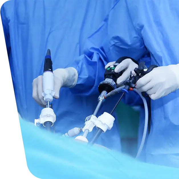 Imaginea oferă un close-up detaliat cu echipamentul medical laparoscopic utilizat în timpul unei intervenții chirurgicale. Aflați mai multe despre beneficiile și tehnologiile implicate în laparoscopie în articolul nostru specializat.