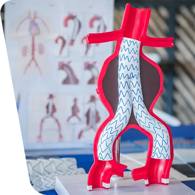 VenArt - Angioplastia arterială periferică cu Stent Graft