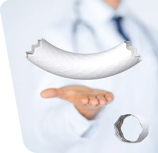 Repararea endovasculară a anevrismelor aortice toracice (TEVAR)