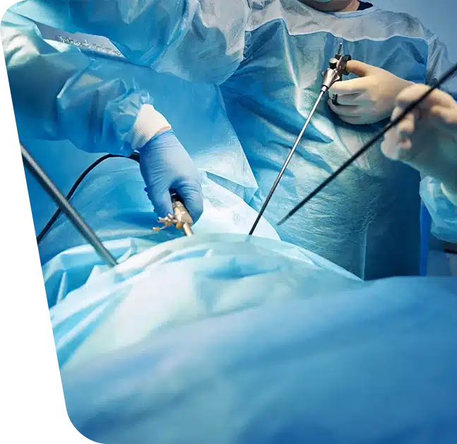 Imagine coperta cu medici specializați în timpul unei intervenții chirurgicale minim-invazice de tumoare suprarenala. Adrenalectomie laparoscopică, se mai poate numi si suprarenalectomia.
