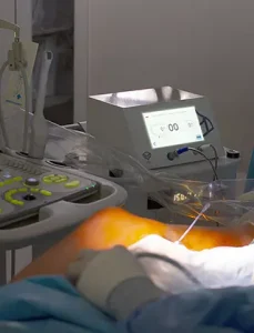 Chirurgie Vasculară 13 Poza reprezentativa proceduri medicale ablatia cu aburi la Clinica Venart.