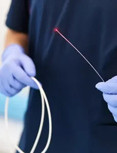 Chirurgie Vasculară 14 Poza reprezentativa proceduri medicale ablatia cu laser la Clinica Venart.