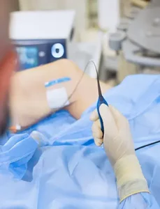 Chirurgie Vasculară 12 Poza reprezentativa proceduri medicale ablatia cu radiofrecventa la Clinica Venart