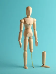 Chirurgie Vasculară 5 Poza Reprezentativa Proceduri Medicale VenArt Amputatie