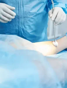 Chirurgie Vasculară 2 Poza Reprezentativa Carduri Proceduri Medicale VenArt Endarterectomie