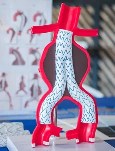 Chirurgie Vasculară 17 Poza reprezentativa proceduri medicale repararea anevrismului aortic evar hibrid la Clinica Venart.