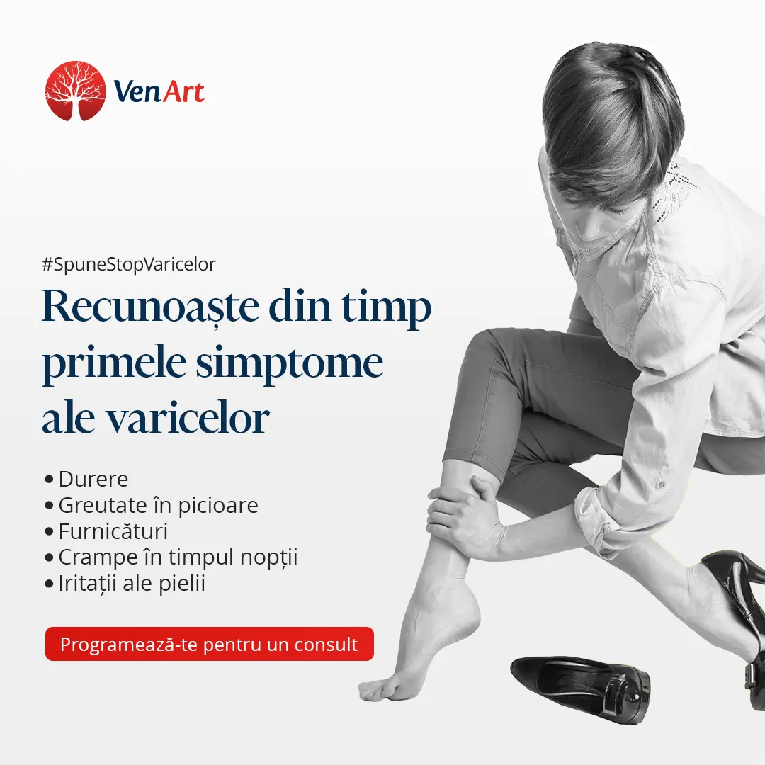 Poze infograma cu simptomele varicelor: Durere, greutate in picioare, furnicaturi, crampe in timpul noptii si iritatii ale pielii