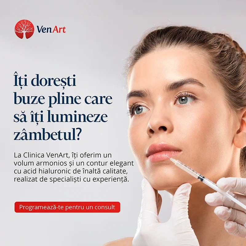 Afis promotional pentru procedura de marirea buzelor cu acid hialuronic si beneficiile ei.
