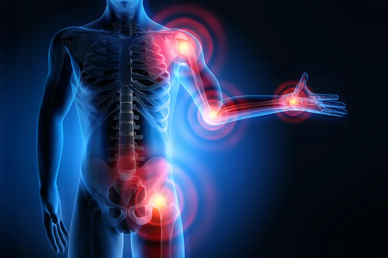3D illustration of a male representing the sensation of pain in the joints of the entire human body (All my bones and joints hurt)