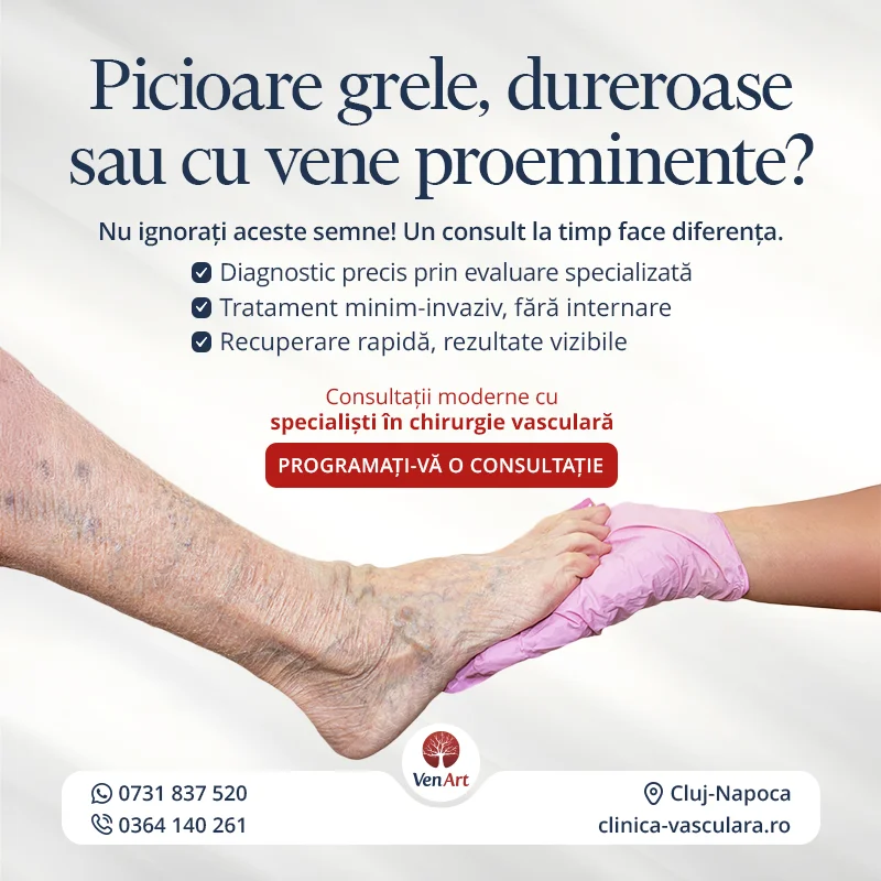Afis tratament varice minim invaziv pentru picioare grele, dureroase sau cu vene proeminente, Cluj-Napoca