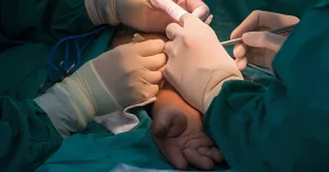 Representative picture of arteriovenous malformation.