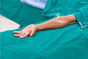Poza reprezentativa pentru fistula arteriovenoasă.