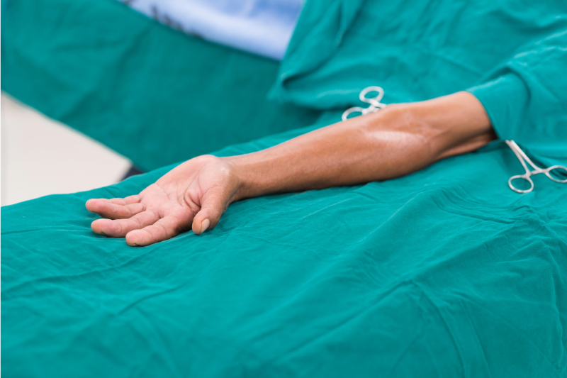 Poza reprezentativa pentru fistula arteriovenoasă.