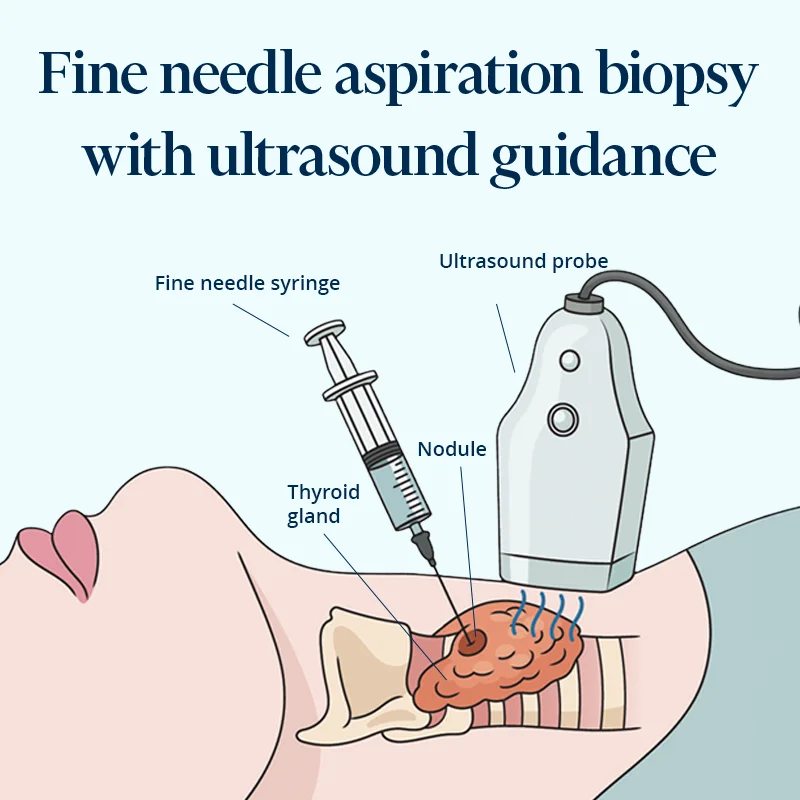 Representative image of the procedure for the fine needle aspiration article.