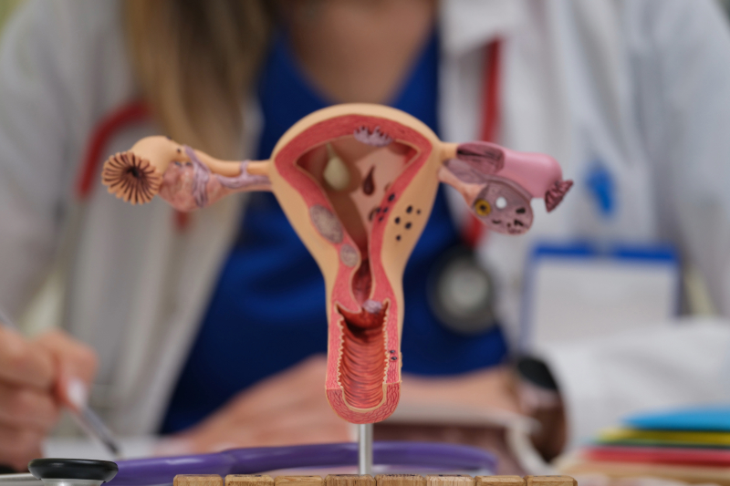 Poza reprezentativa pentru prrocedura de prolaps genital.