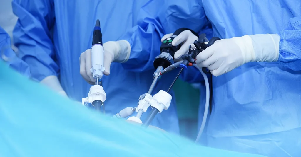 Featured imaged representative for the general laparoscopic surgery page of the VenArt clinic in Cluj-Napoca, Romania. The image shows a medical team during a minimal invasive laparoscopic surgery