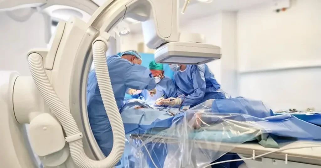 Representative image of doctors during Vascular or Endovascular Surgery at VenArt medical clinic