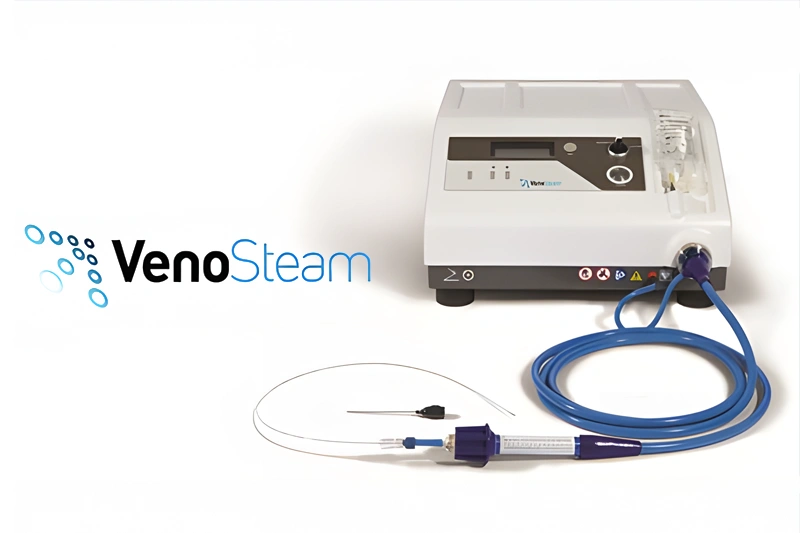Representative image for the Venosteam treatment method.