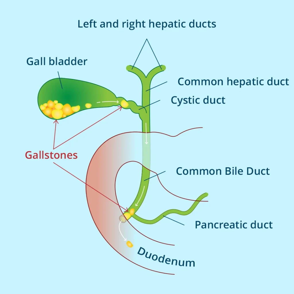 Detailed image with left and right hepatic ducts
