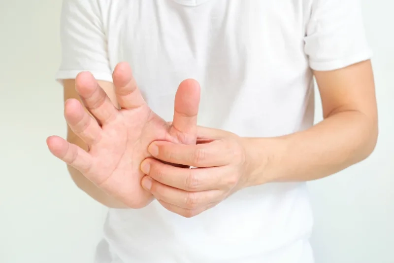Representative image of Quervain's tenosynovitis