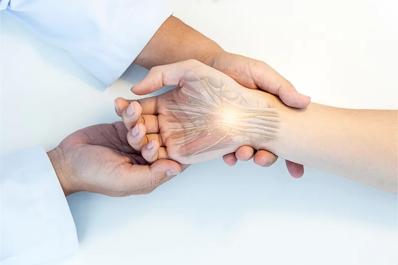 Representative image for carpal tunnel syndrome procedure.