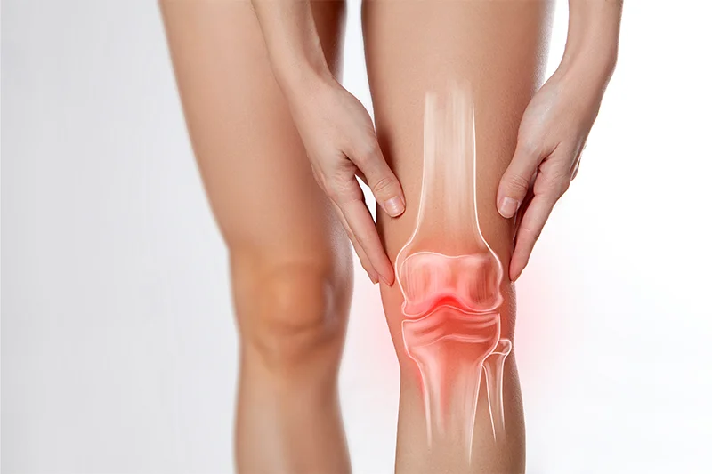 Representative image for knee arthroscopy procedure.
