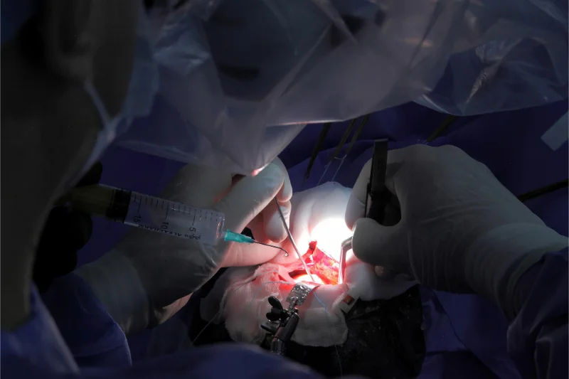 Representative image for the Tumor Resection procedure