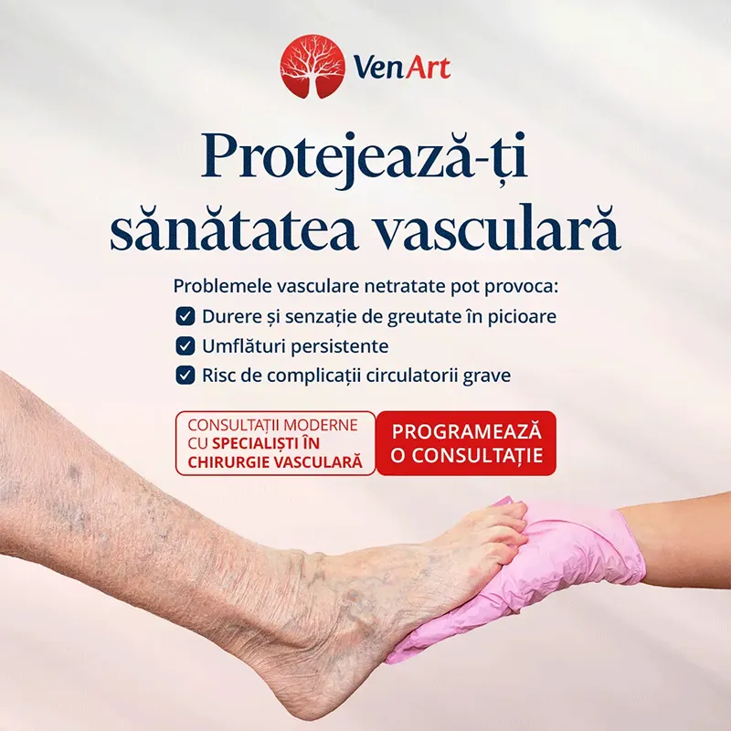 Imagine care promoveaza tratamentul venelor varicoase sau ale varicelor la Clinica VenArt din Cluj Napoca și București.