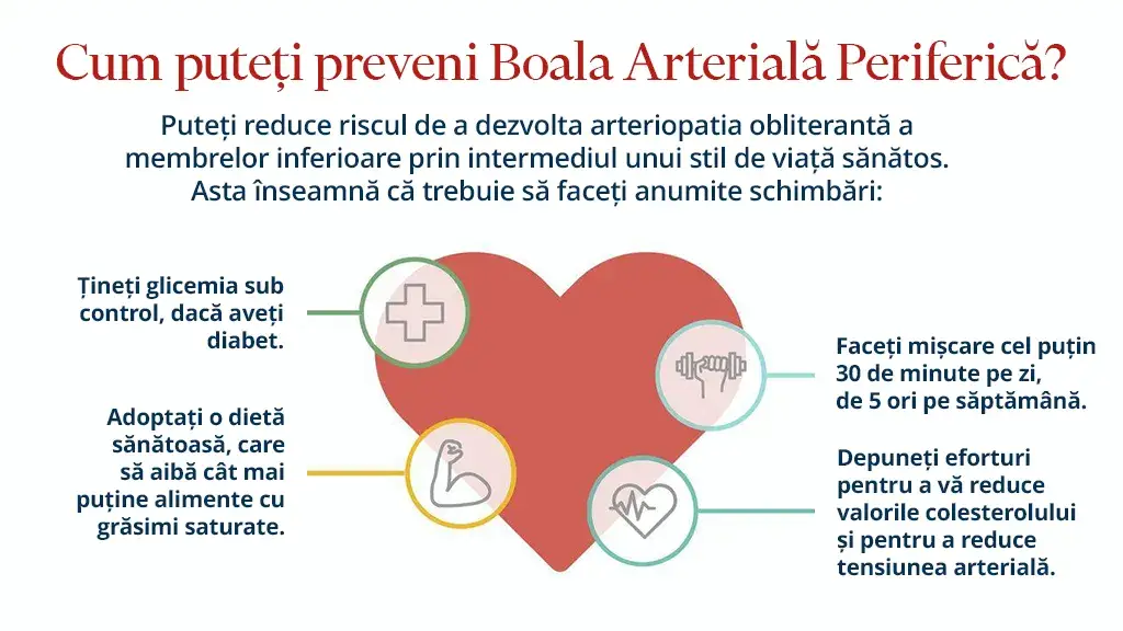 Boala arteriala periferica preventie
