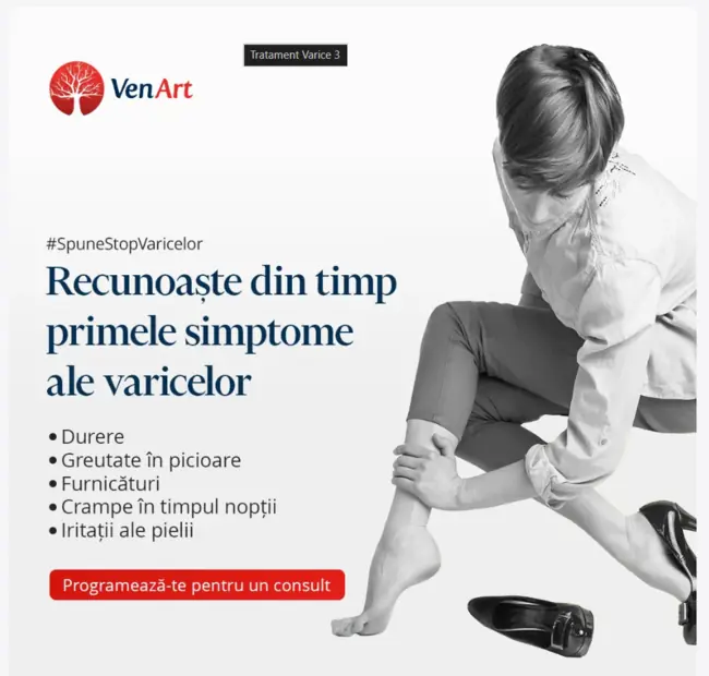 Programează-te pentru un consult varice - Clinica VenArt